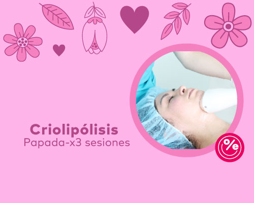 criolipolisis-papada-26abr